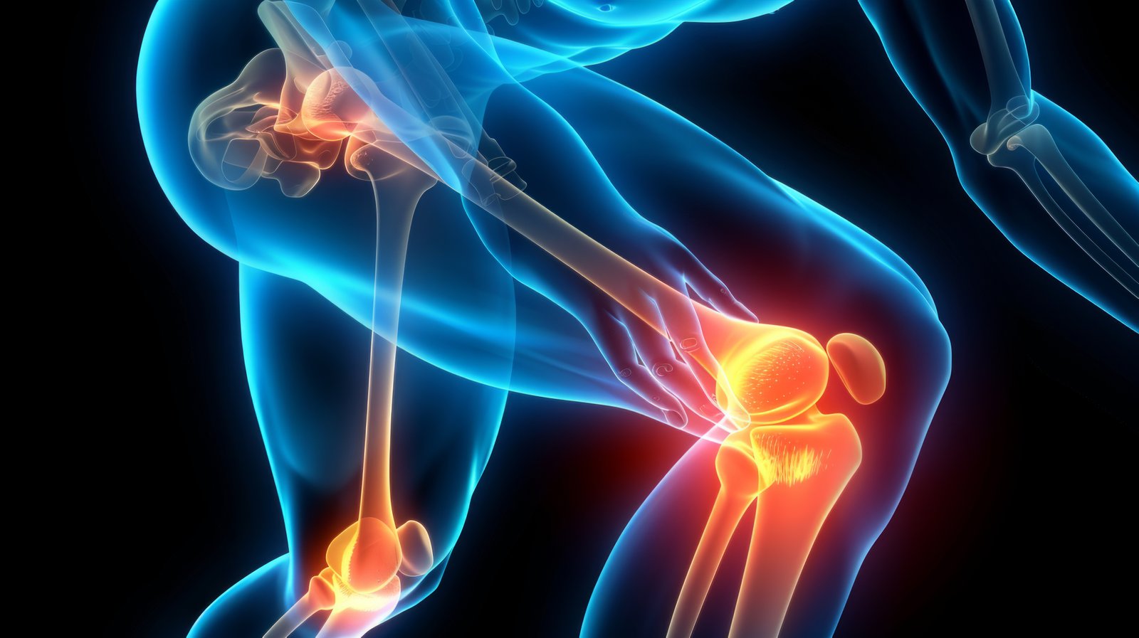 Revision Knee and Hip Replacement in Ahmedabad