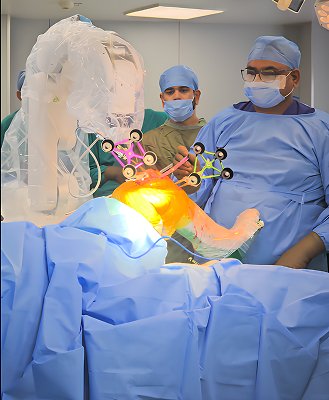 Robot-assisted Knee Surgery